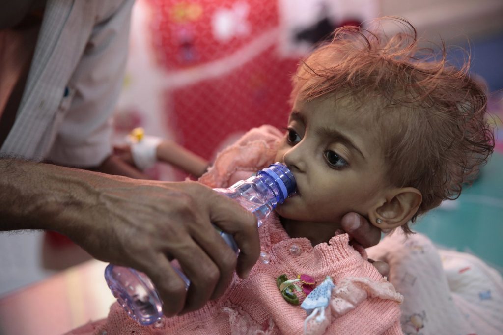 Krisis Yaman: 85.000 Anak Diduga Meninggal Kelaparan